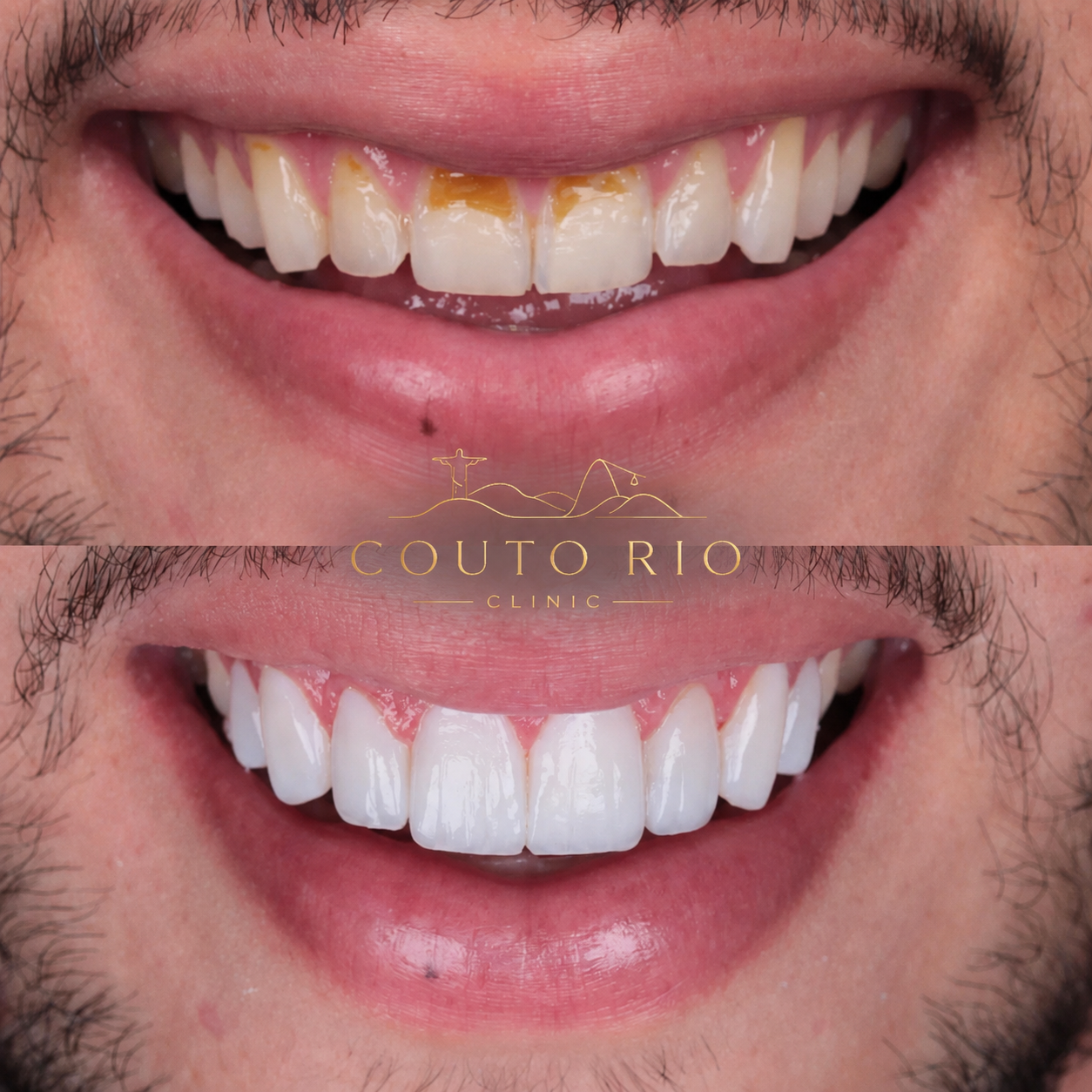 Resultado Couto Rio Clinic 6